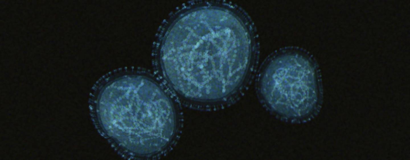 Monkeypox virus closeup shows three opaque white circles of different sizes against a black background